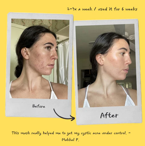 Exfoliating Mask - Detox
