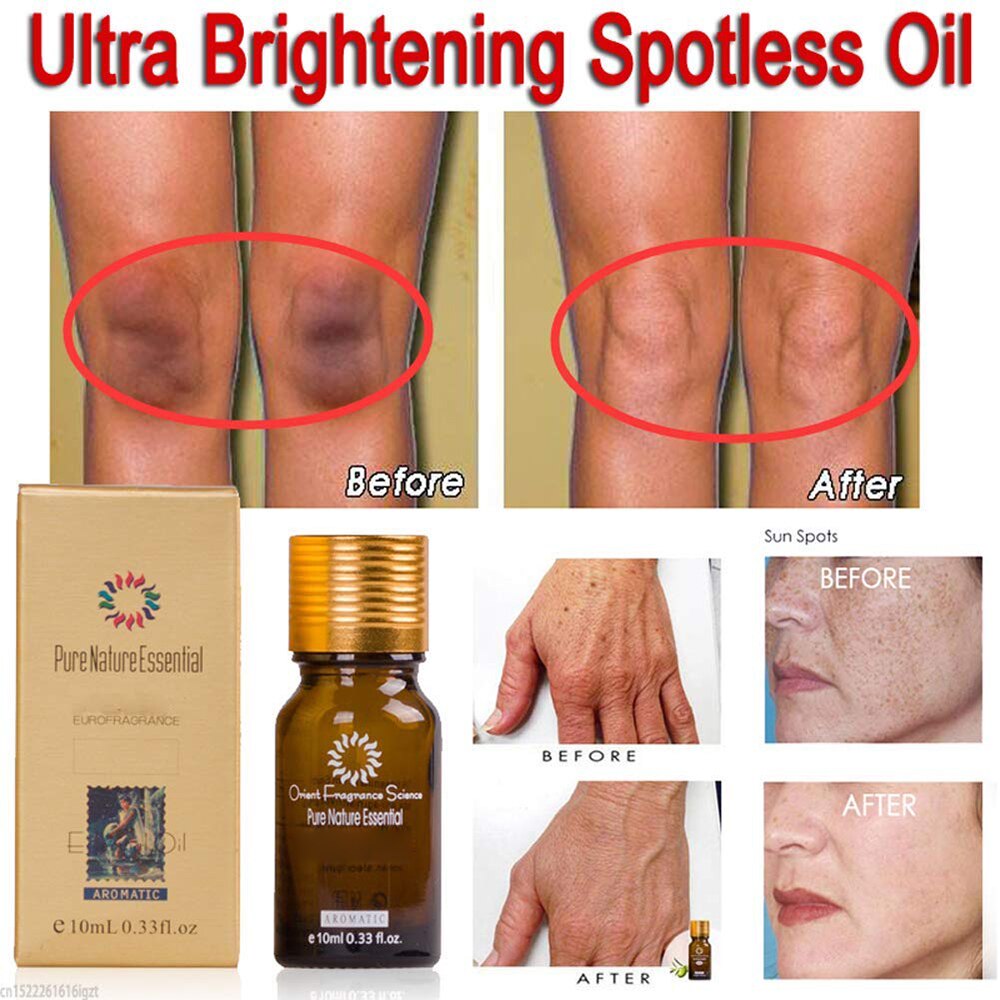 Essential Oil